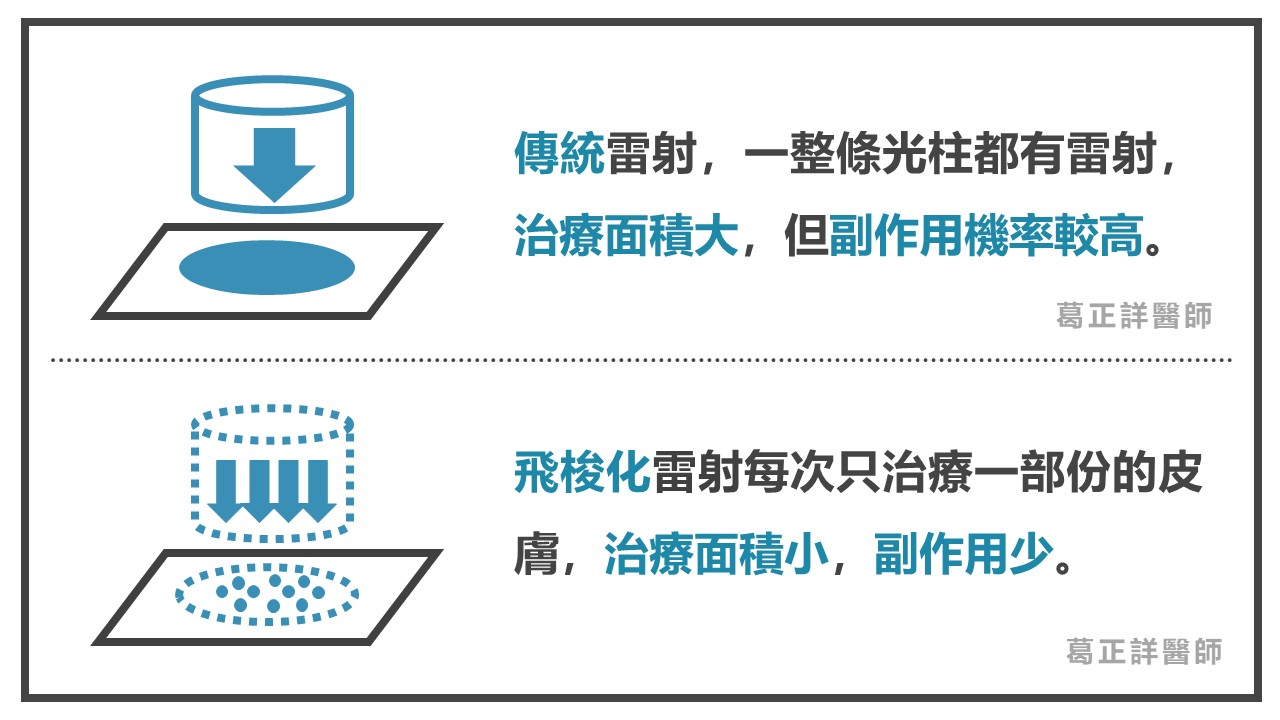 飛梭雷射的意義